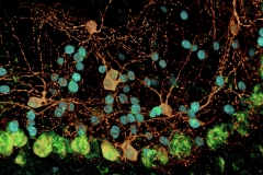 Septuplets: cerebellar molecular layer interneurons