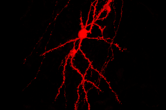 Spiny stellate neuron