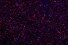 Astrocytes 'stars' in the night sky