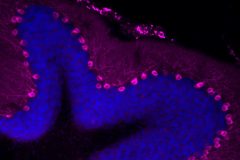 SynDIG1 expression in mouse cerebellum
