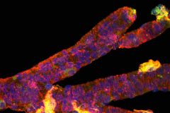 Branching Arteriole and Pericytes