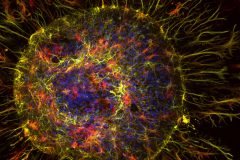 Toxic astrocytes in ALS