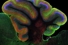 Tree of Life within the Cerebellum