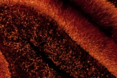 Cerebellar granule cells