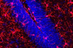 Unveiling the Intricate Guardians: Microglia's Watchful Stance in the Dentate Gyrus