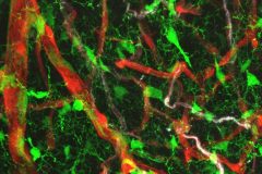 Cerebrovascular immune homeostasis