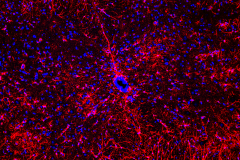 Inflammatory astrocytes in ALS