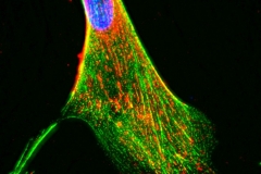 Connective tissues in cutlured astrocyte