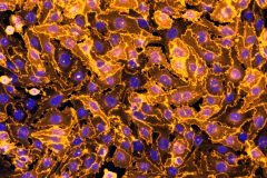 Tight Junctions in Endothelium of Blood-Brain Barrier
