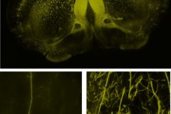 Brain slice of YFP mouse