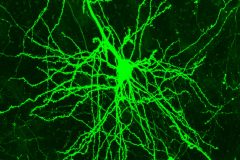 Neuronal network