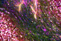higher-mag-JJ-Leak-lab-PLP-488-Synaptophysin-555-IBA1-647-NeuN-800-submitted-for-NeuroArt