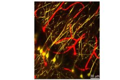 Hippocampal Neurons and Aapillaries