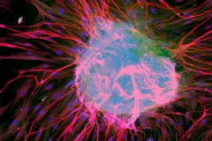Multipotent adult intestinal neurosphere