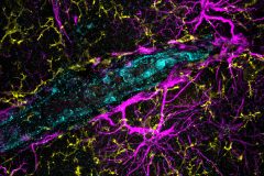 Glial Components of the Blood-Brain Barrier in Human FCD-Associated Epilepsy