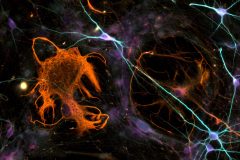 Neuron "Galaxy"