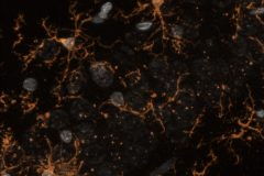 Microglial cells at rat hippocampus