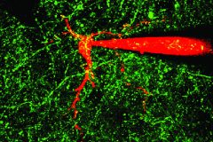 Cholinergic Interneuron with Dopamine Axons