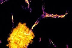 Astrocyte Endfeet Envelop Cerebral Blood Vessels