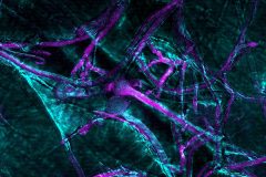 Neuron or fungus?