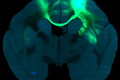 Viral tracing of long-range cortical projections in marmoset
