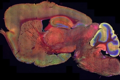 Slide scanning confocal microscopy image