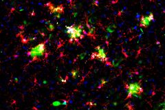 Microglia trying to engulf amyloied-beta