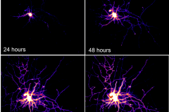 Motor neuron time lapse