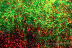  Mouse Neurons and Astrocytes from Brain