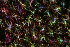 Human microglia inside the mouse brain
