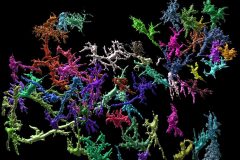 3D reconstruction of human activated microglia inside the mouse brain