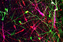 Human Fragile X and control neurons in the mouse brain