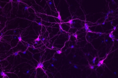 Rat primary cortical neurons