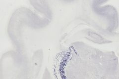 Interneurons During Development