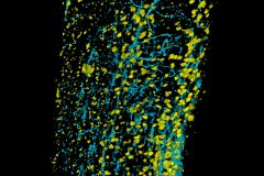 See through spinal cord