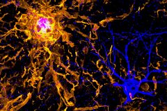 Microglia Supernova