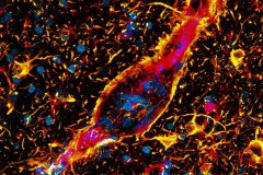 Zika Virus Infecting the Brain