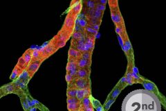 CHRISTMASSY MICROVESSELS FROM RAT BRAIN