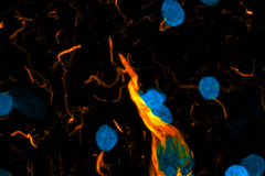 Neuron on fire