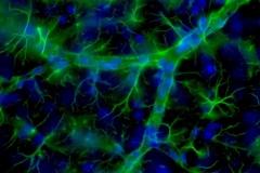 Astroglial cells and cerebral vasculature