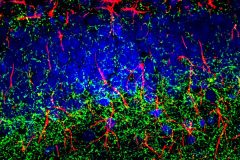 Cannabinoid 1 Receptor Distribution in Brain Cells