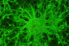 Cultured Neurons