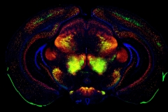 Coronal brain section mouse