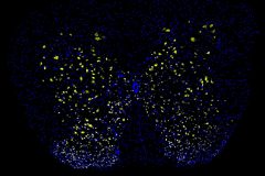 Making the right movement - Mouse spinal cord neurons