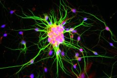 Hippocampal neurons immunostained with MAP2 (green), BDNF (red) and Dapi (blue) at 20x magnification with scale bars, 20 μm