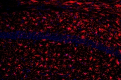 Microglia Storm