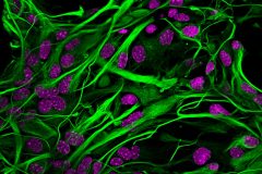 Into the glial web