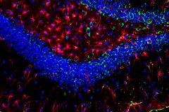 Fructose consumption induces inflammation and reactive gliosis in the hippocampus