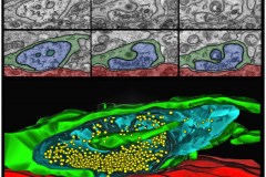 Synaptic sculpting