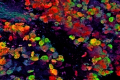Vagal neurons on cannabinoids